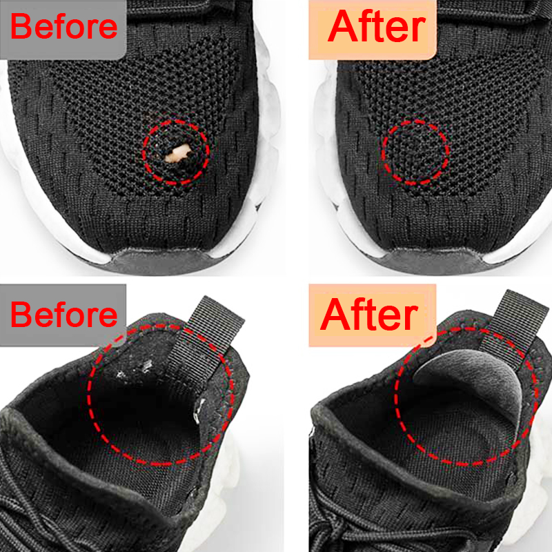 Sports Shoes Patches Vamp Repa - đánh giá và giá Sports Equipment Repair